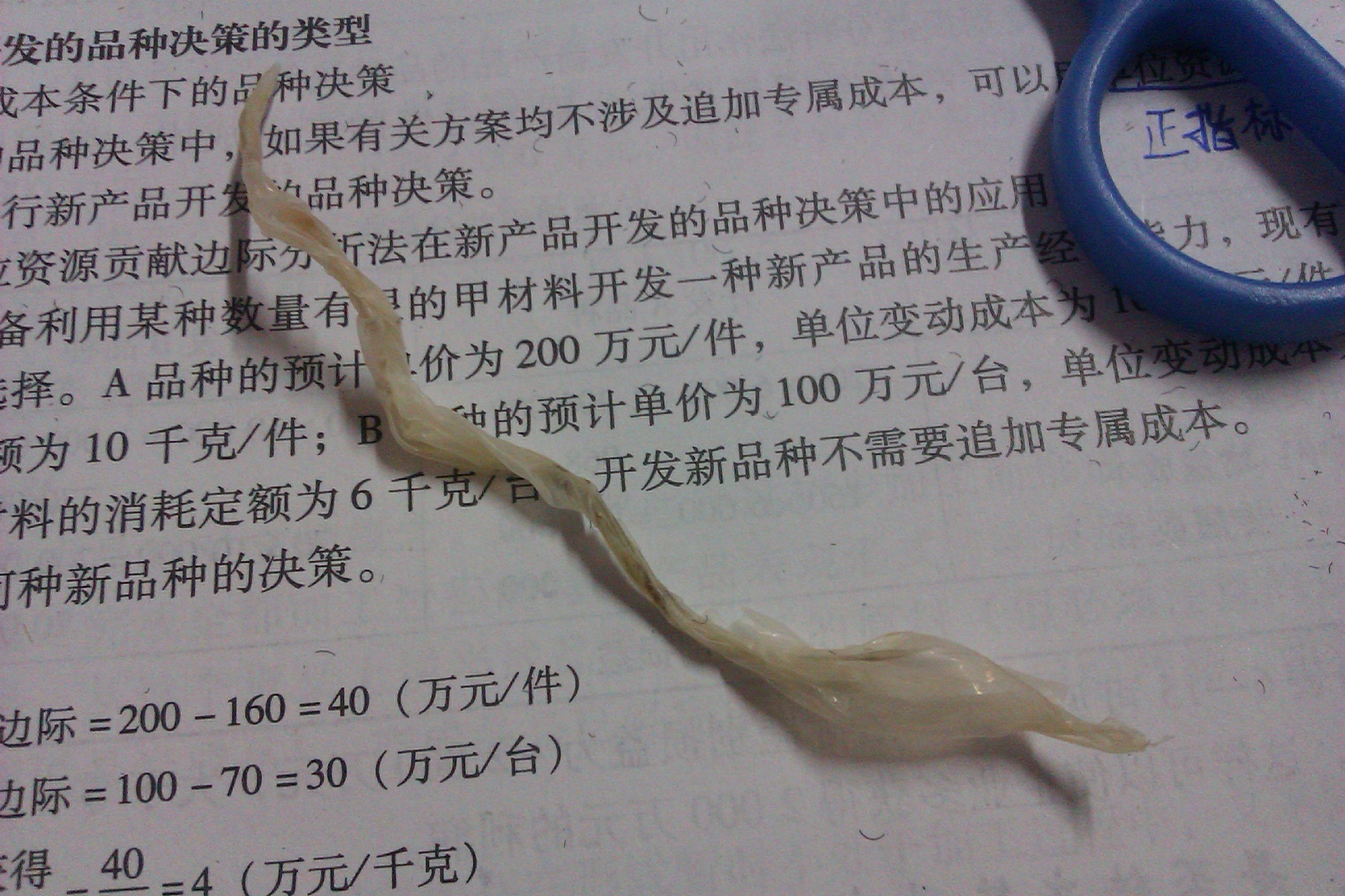 楼主好奇亲身体验了一把,头筋里原来真是TT么?大家看过来么~
